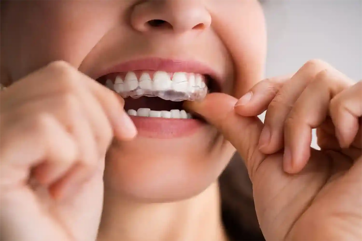7 Steps To Stop Teeth Grinding At Night Naturally