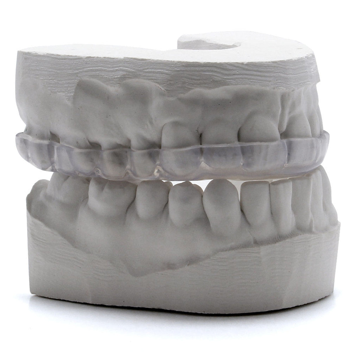 Best Hybrid Night Guard for Moderate Teeth Grinding Problems