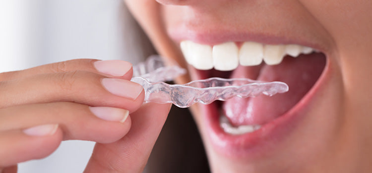 The 7 Best Custom Night Guards Online in 2025