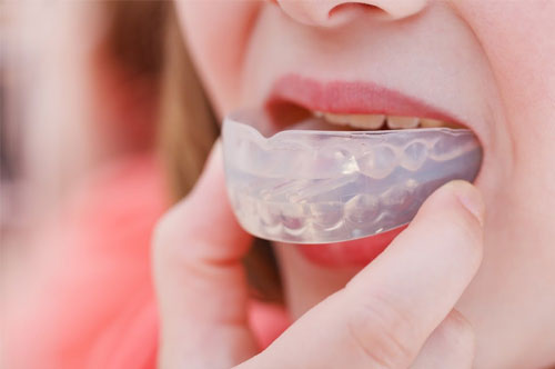 How to Use a Night Guard for TMJ Pain Relief