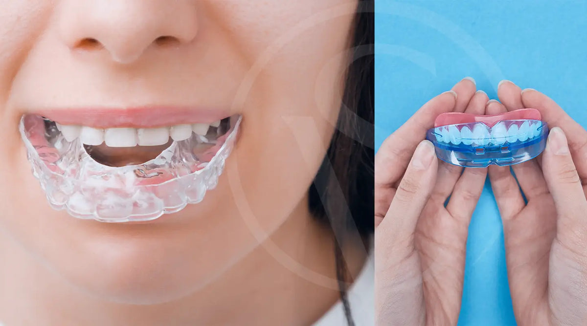 A Guide to Finding an Affordable (And Quality) Night Guard for Bruxism