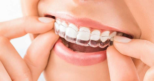 What Should You Know About Custom Dental Night Guard Online